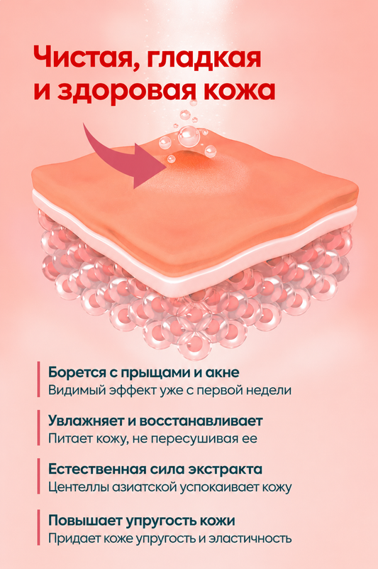 FACEUPSKIN® Acne Cream — Крем против акне и прыщей 40 мл