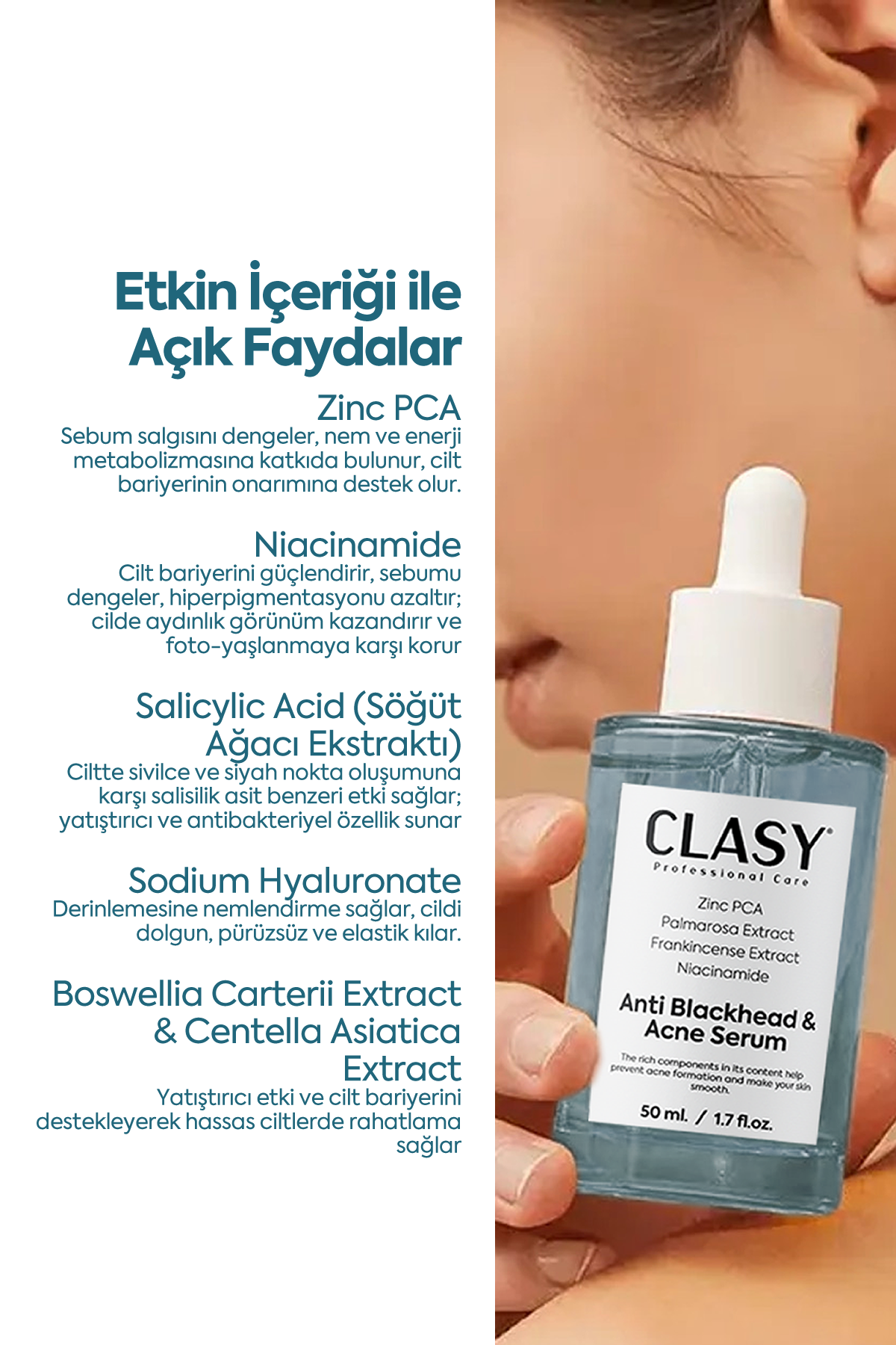 Anti Blackhead & Acne Serum — Сыворотка против чёрных точек и акне 50 мл