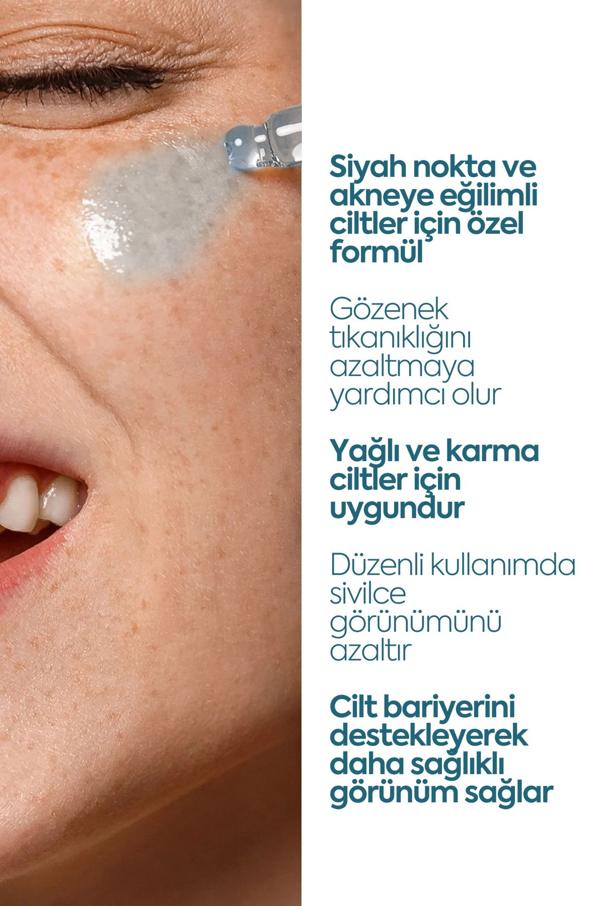 Anti Blackhead & Acne Serum — Сыворотка против чёрных точек и акне 50 мл