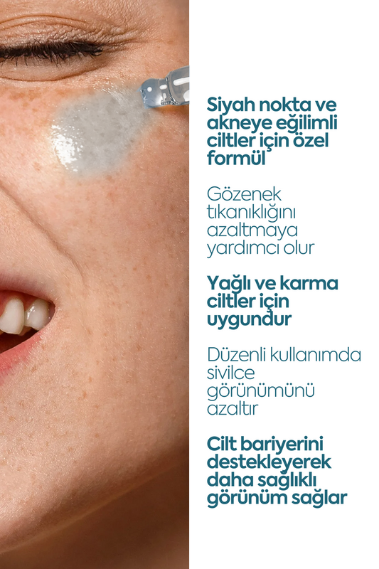 Anti Blackhead & Acne Serum — Сыворотка против чёрных точек и акне 50 мл