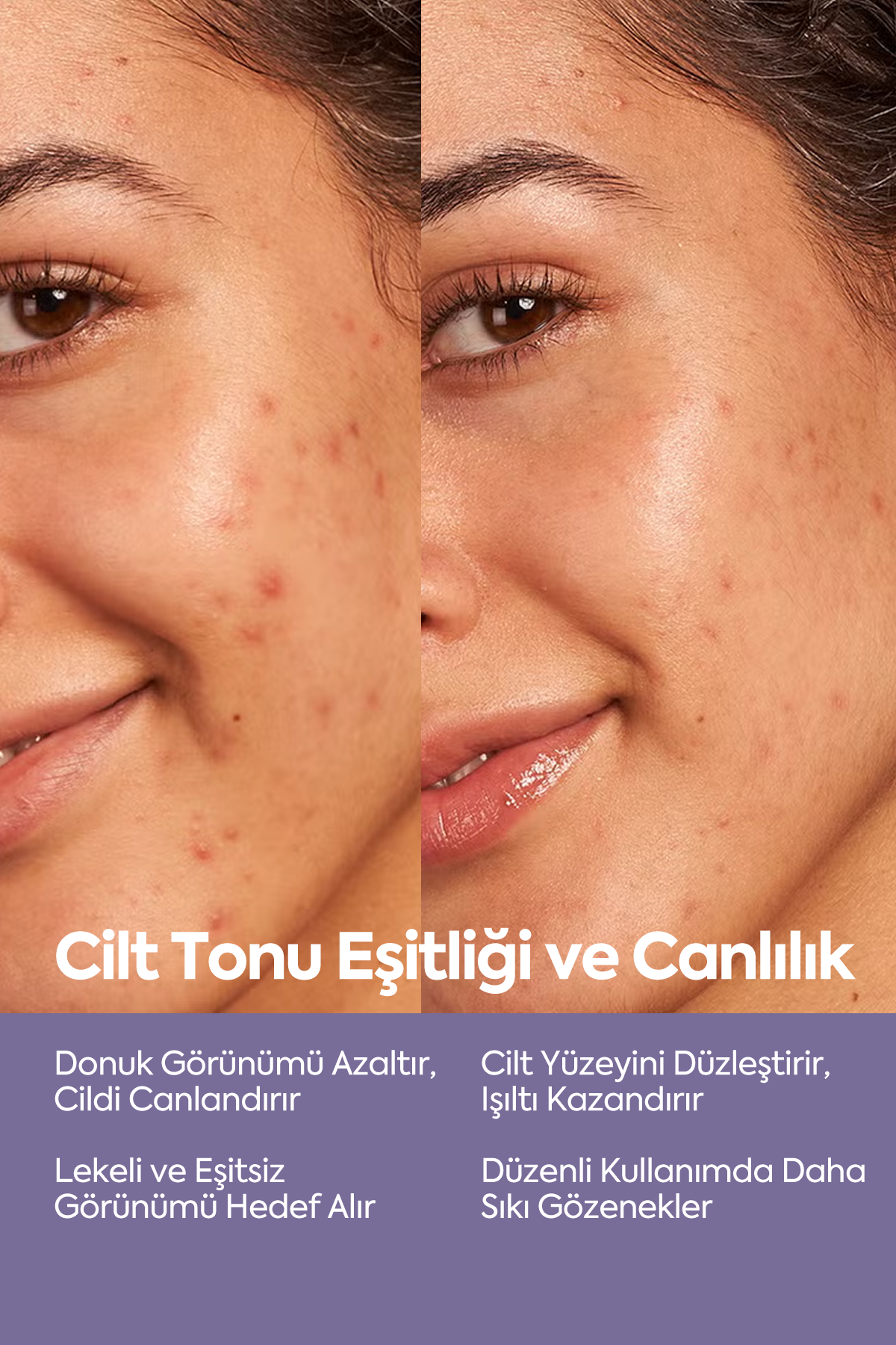 Exfoliating AHA-BHA Serum — Сыворотка-пилинг для выравнивания тона кожи 50 мл