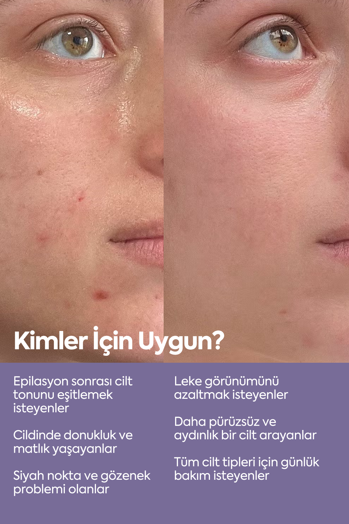 Exfoliating AHA-BHA Serum — Сыворотка-пилинг для выравнивания тона кожи 50 мл