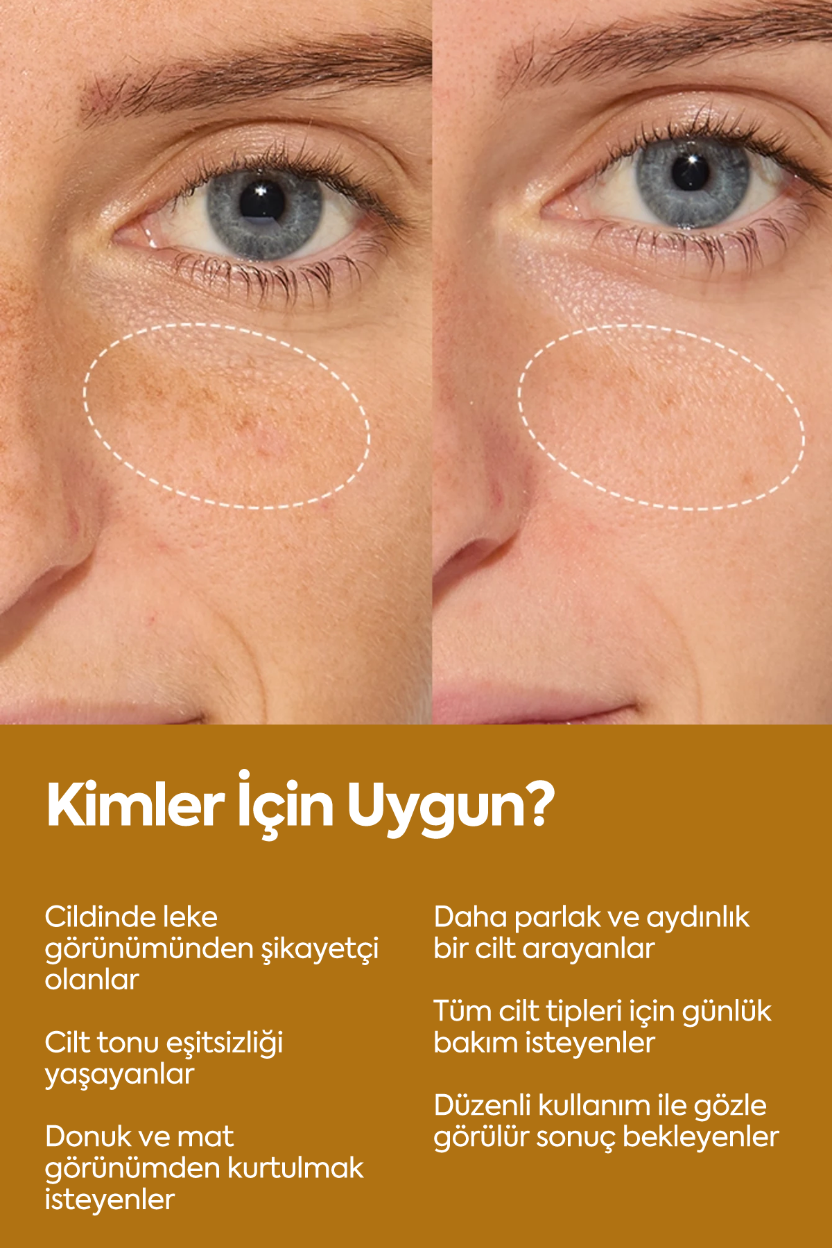 Brightening Serum — Осветляющая сыворотка против пигментных пятен 50 мл