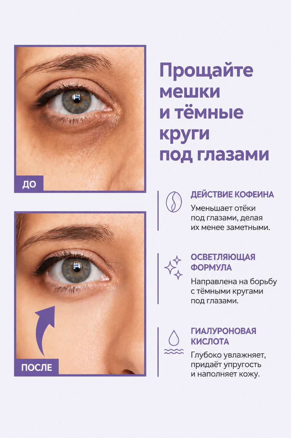 FACEUPSKIN® Under Eye Cream — Крем для век от мешков и тёмных кругов 40 мл