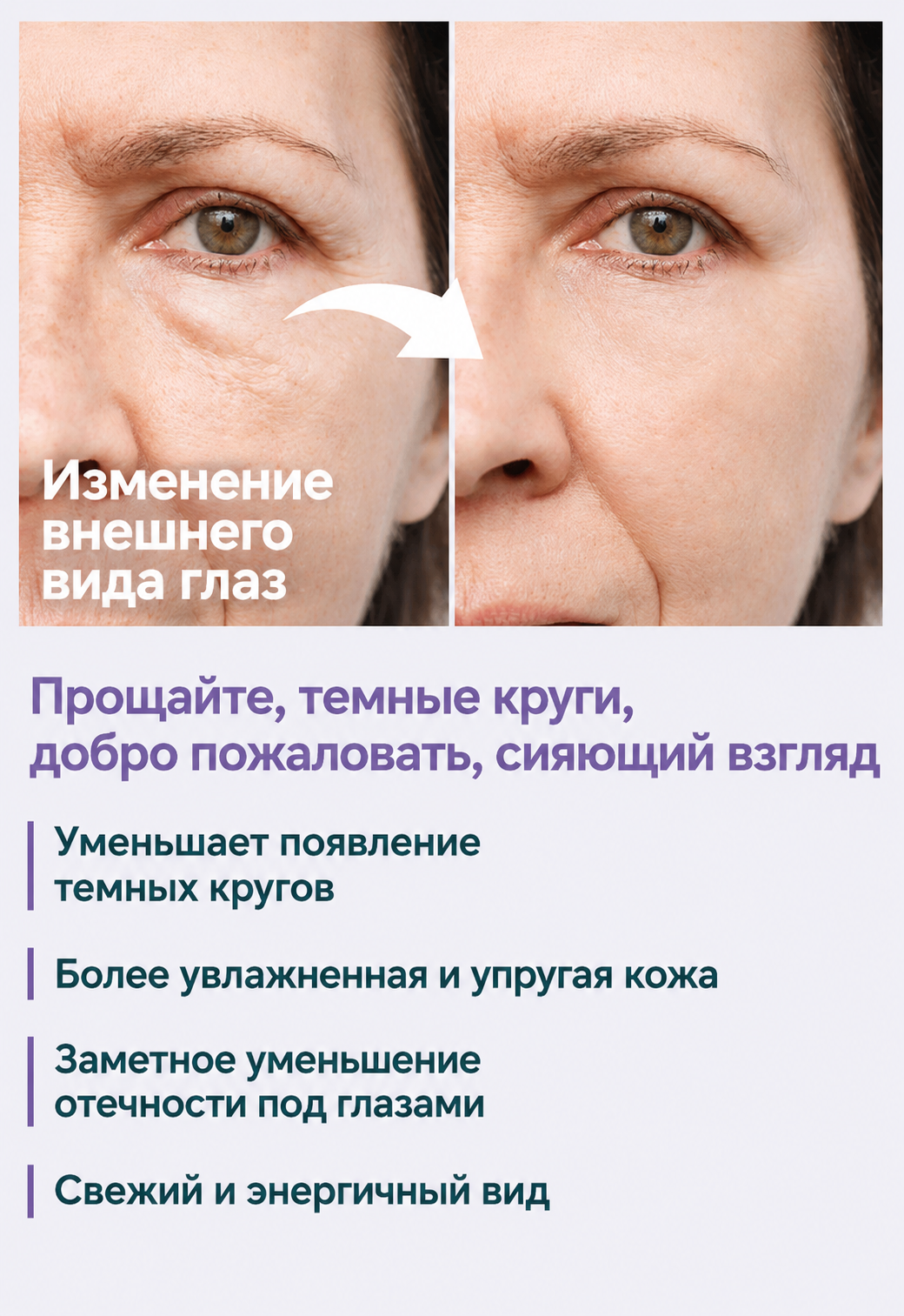 FACEUPSKIN® Under Eye Cream — Крем для век от мешков и тёмных кругов 40 мл