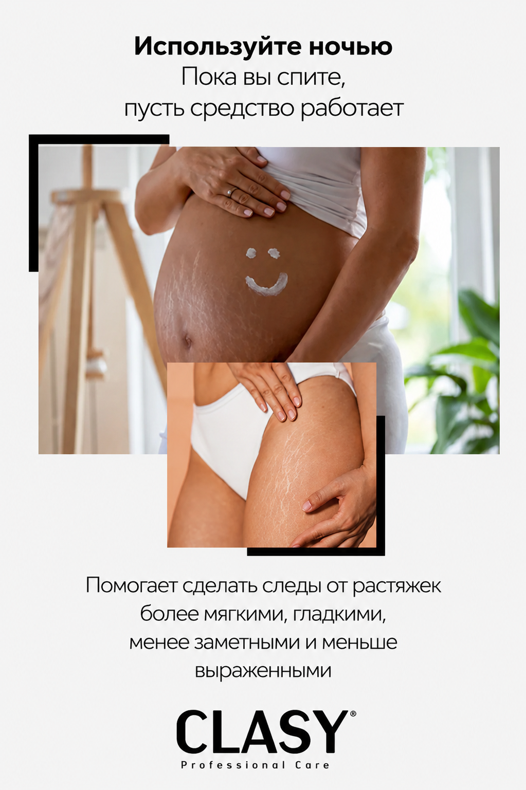 Scars & Stretch Marks — Восстановление от растяжек и рубцов с центеллой азиатской 100 мл