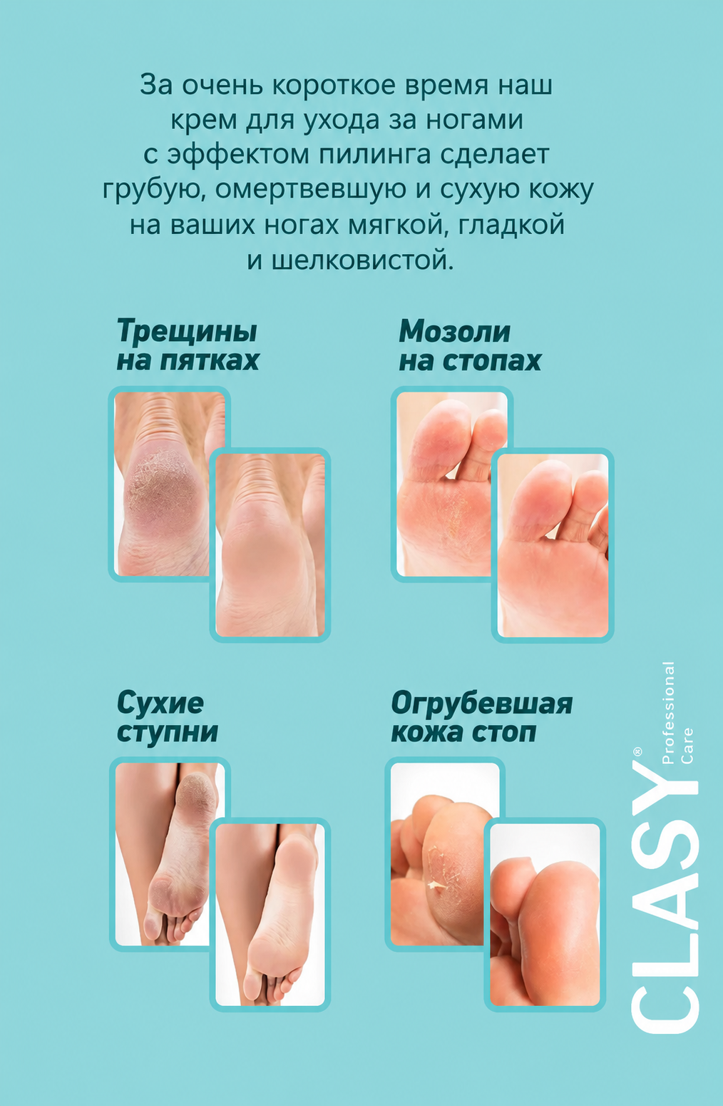 Crack Repair — Крем-уход для потрескавшихся пяток и стоп 100 мл