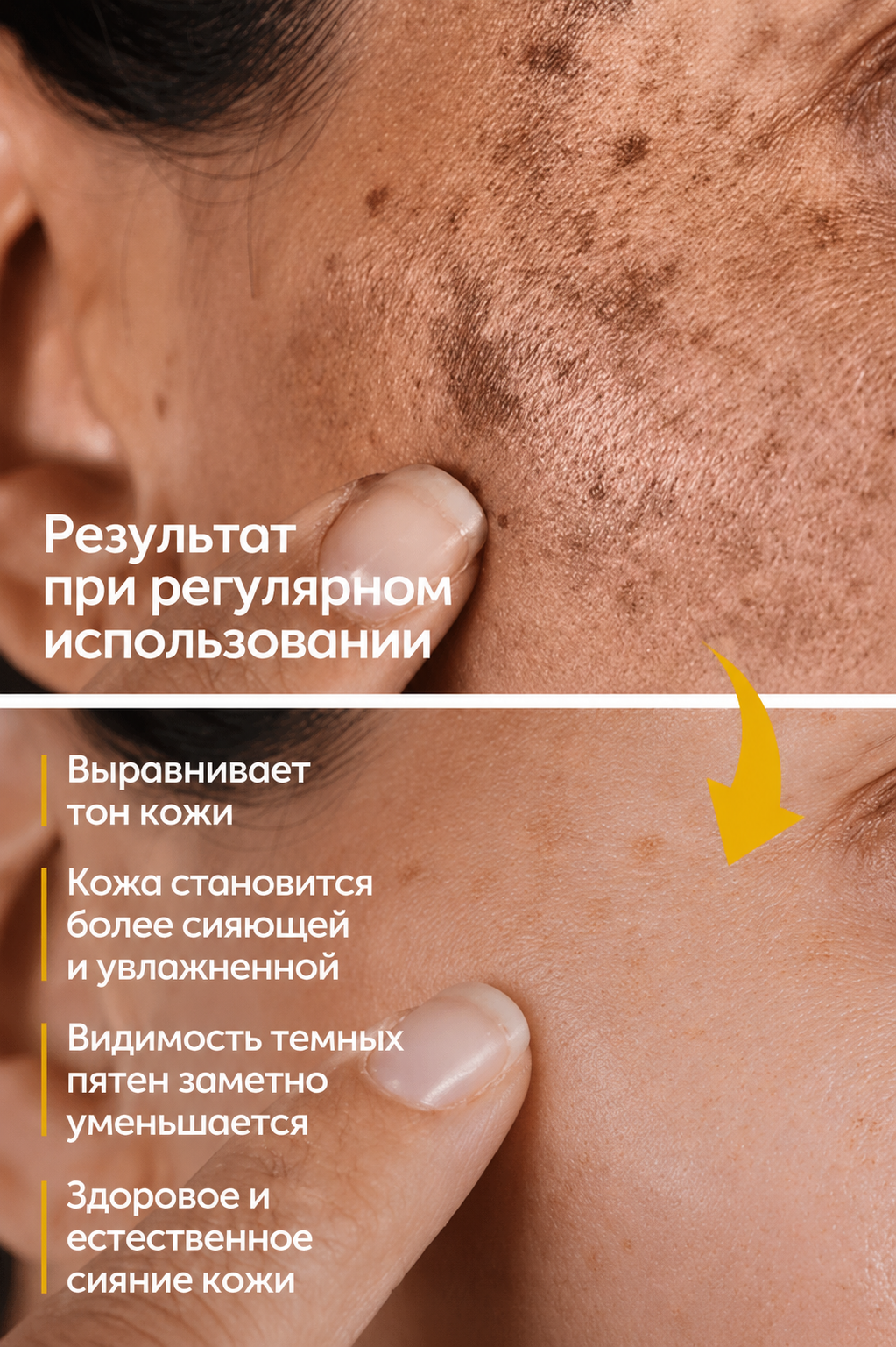 FACEUPSKIN® Spot Cream — Осветляющий крем против пигментных пятен 40 мл